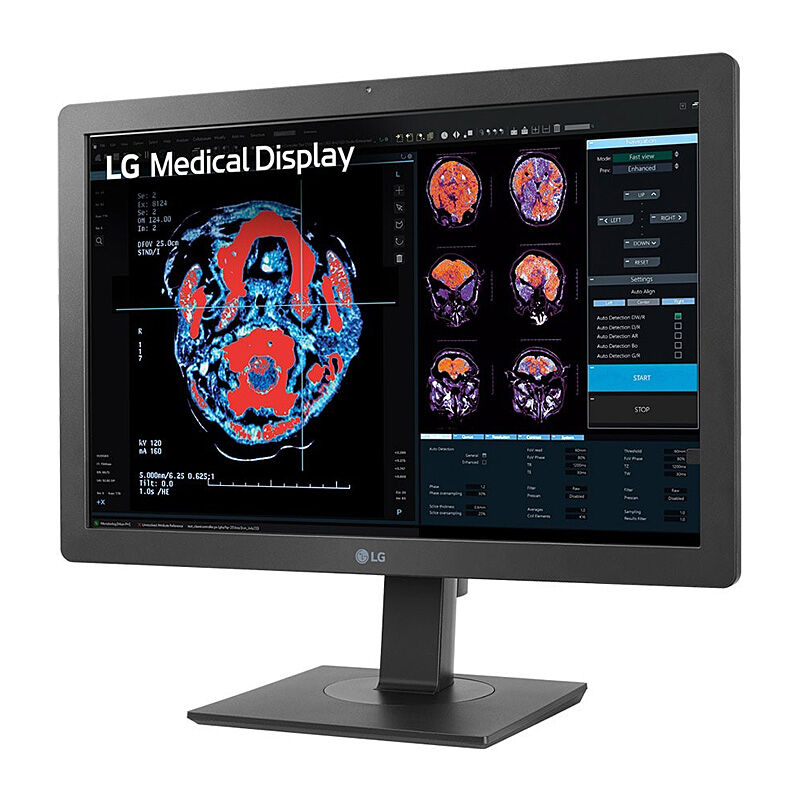 LG 24'' Clinical Review Monitor