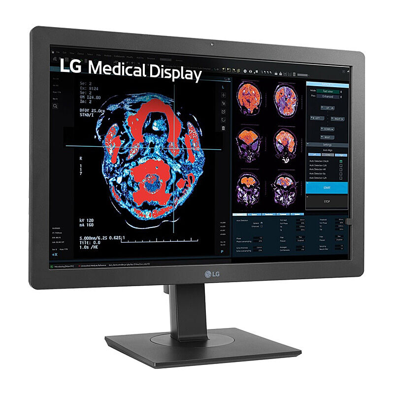 LG 24'' Clinical Review Monitor