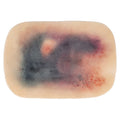 TraumaSim Self-Adhesive Large Haematoma